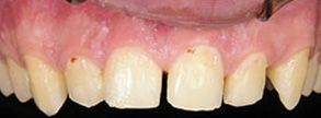 Smile Gallery - Before